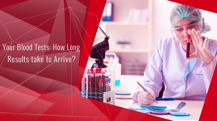 Your Blood Tests: How Long Results take to Arrive?