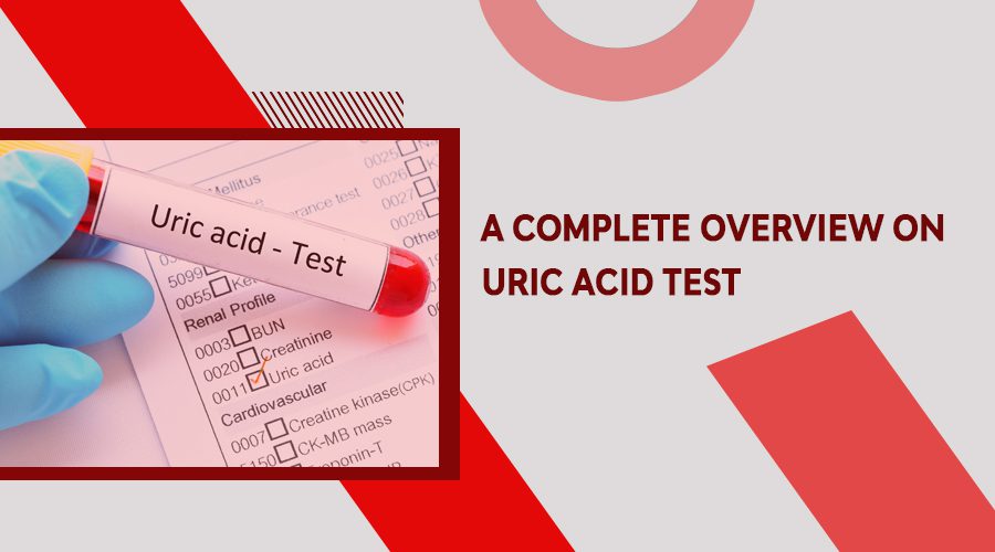 uric acid test