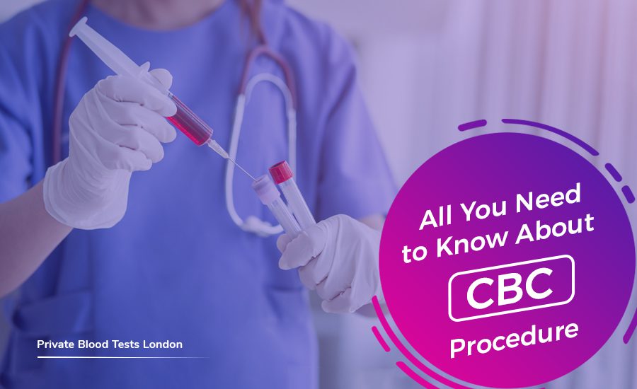ALL YOU NEED TO KNOW ABOUT CBC PROCEDURE