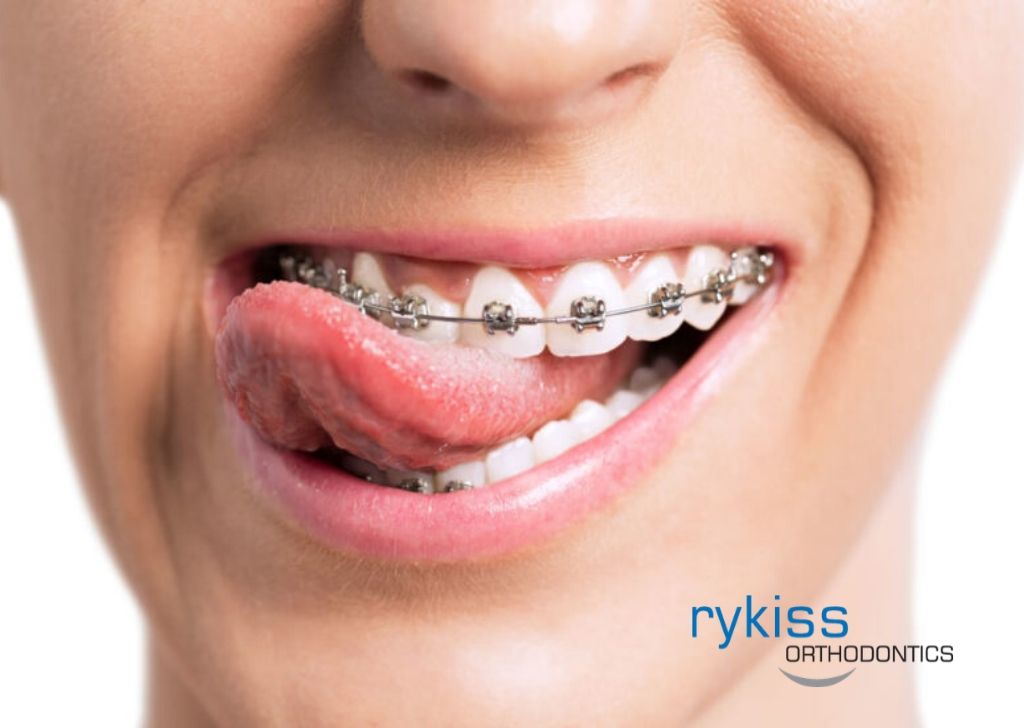 An Intended Significance of Orthodontic Proceedings