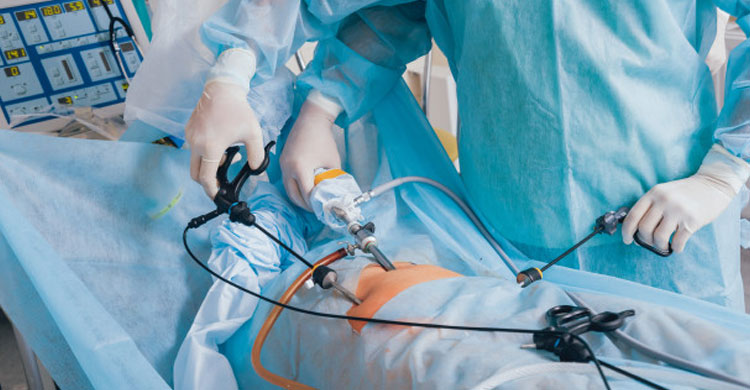 ADVANTAGES OF LAPAROSCOPIC SURGERY IN UROLOGY