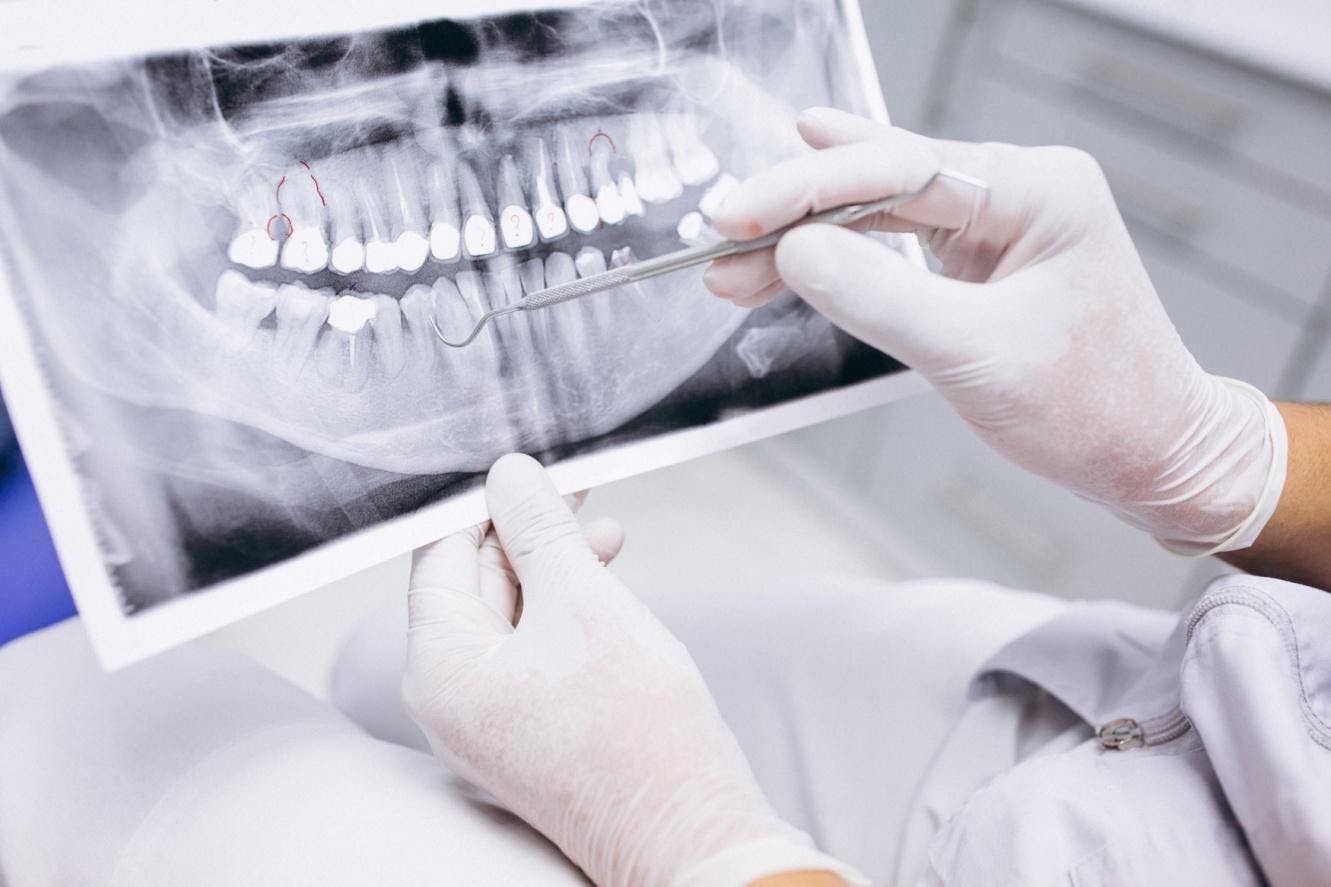 What Is A Dental X-Ray? Why Should You Choose The Best Dental X-Ray Clinic?