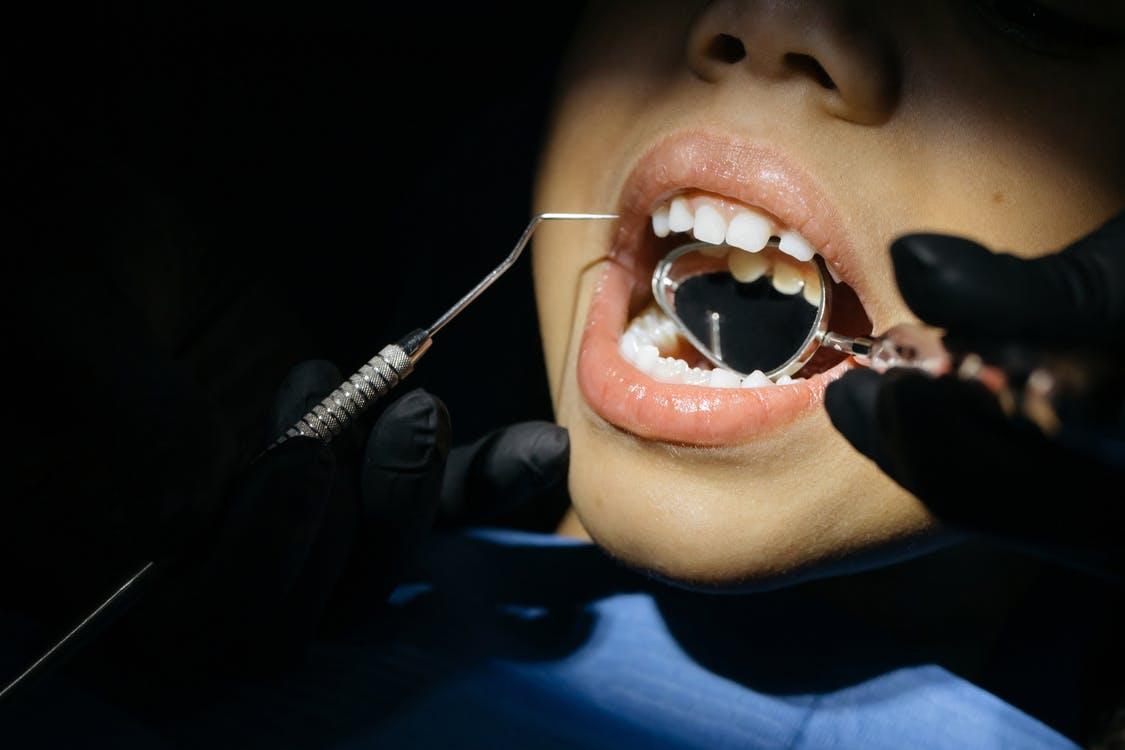 Dental cavities in kids. What causes it and how to prevent it?