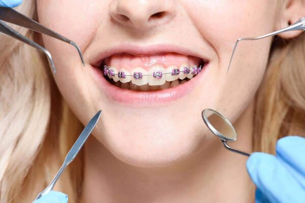 orthodontics for teens