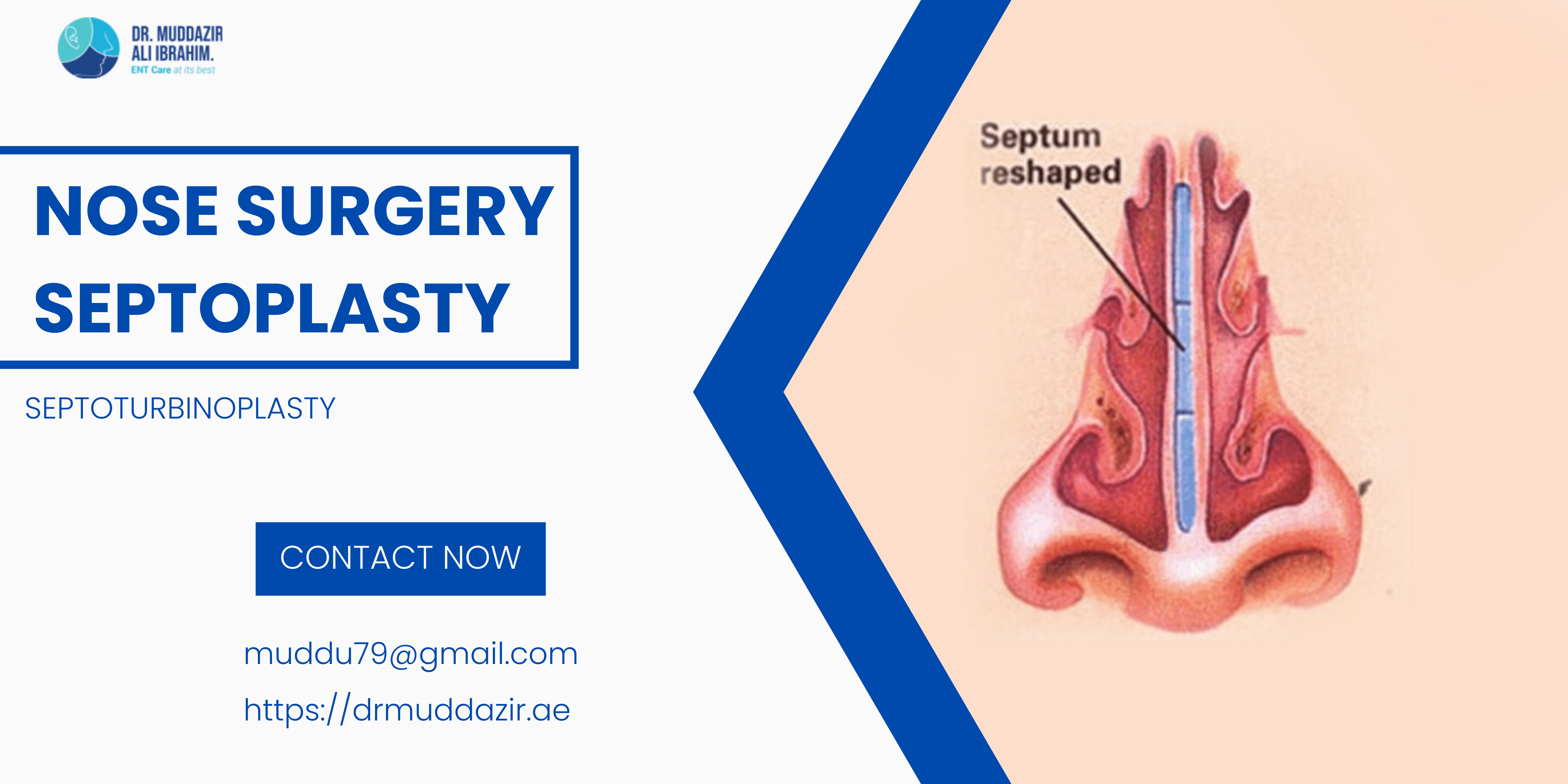 septoplasty surgery