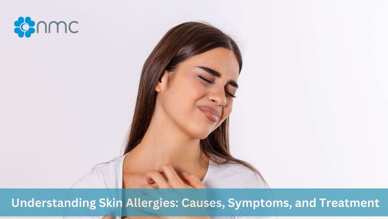 skin allergy treatment