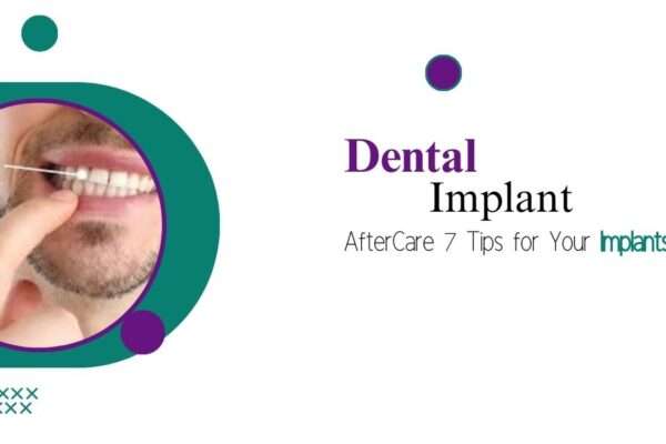 dental implants wimbledon