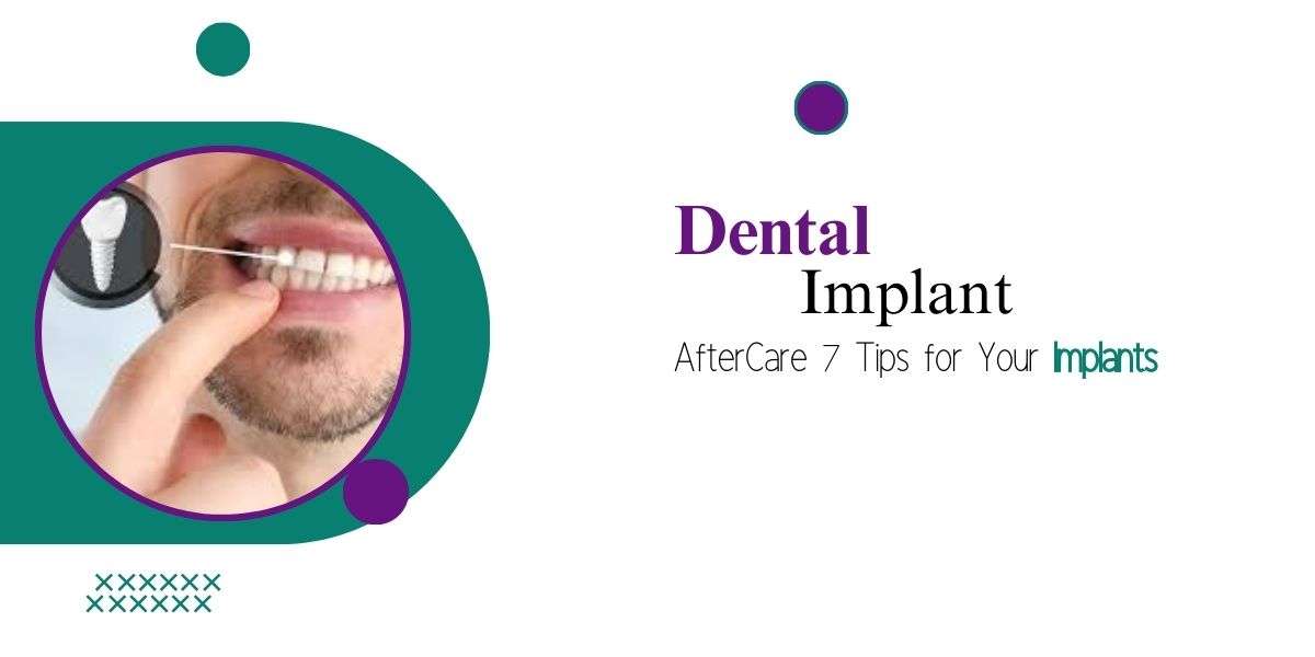 dental implants wimbledon